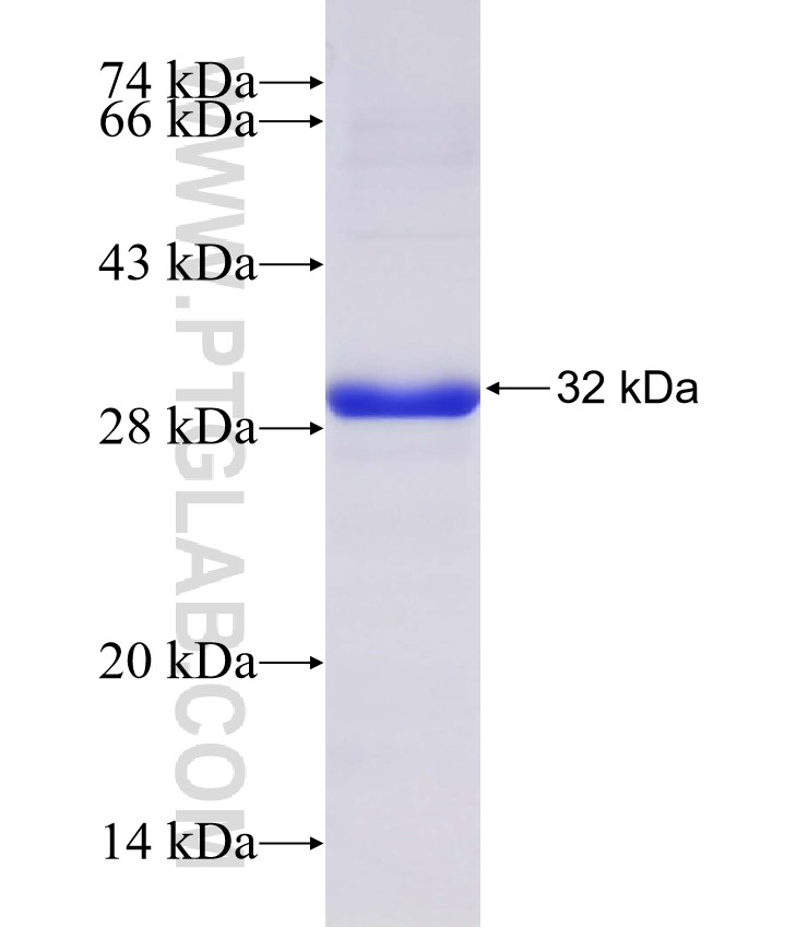 MEI4 fusion protein Ag31871 SDS-PAGE MEI4 fusion protein Ag31871 SDS-PAGE