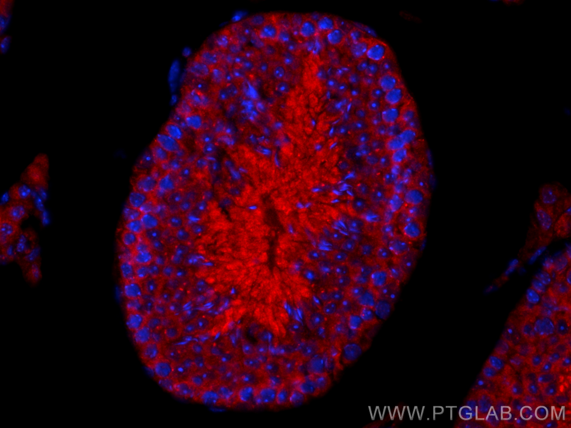 IF Staining of mouse testis using 31759-1-AP