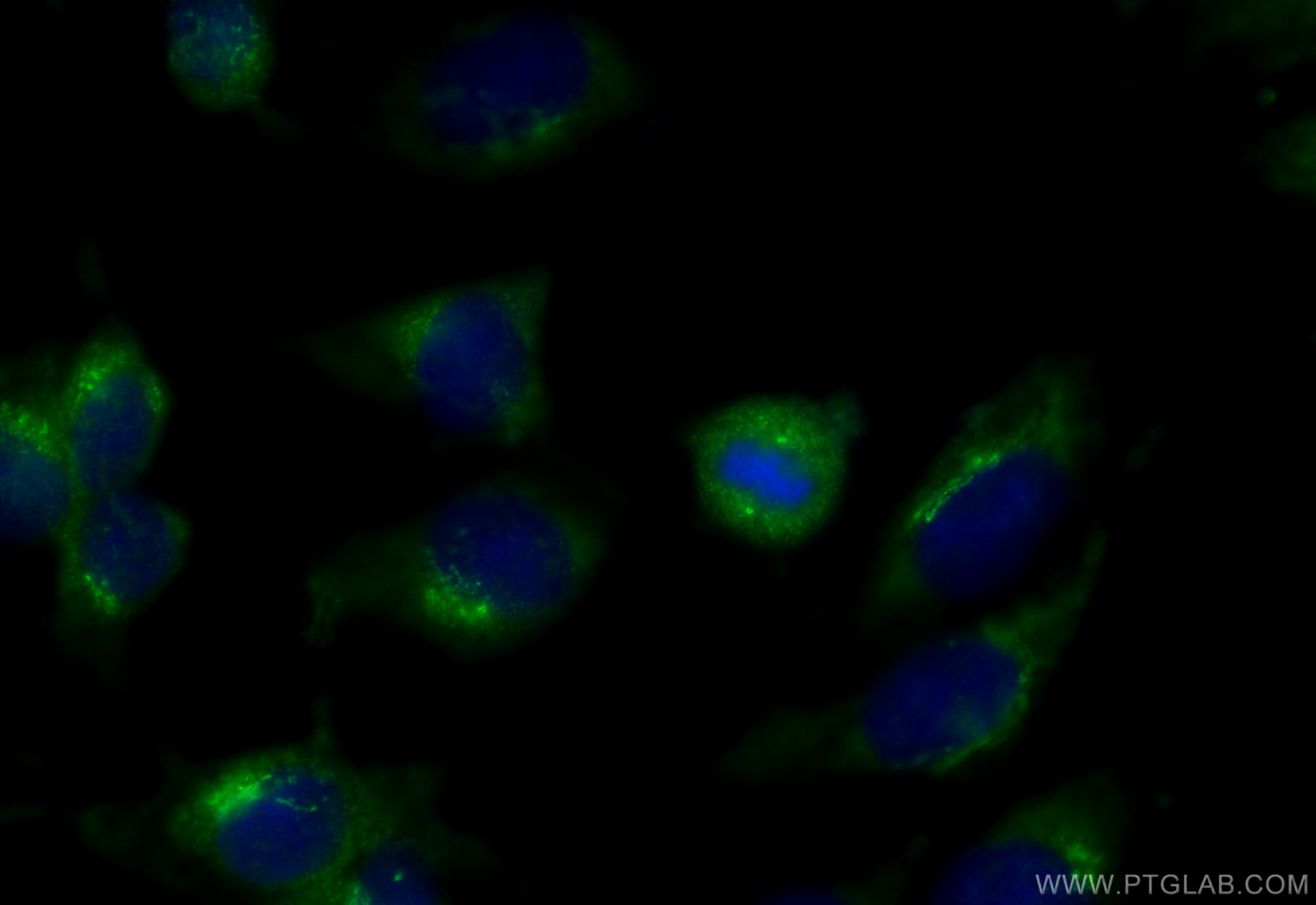 IF Staining of MDCK using 31759-1-AP