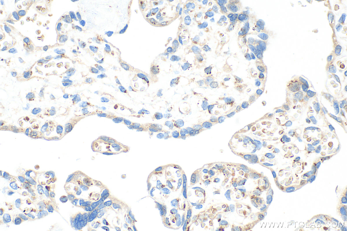 IHC staining of human placenta using 31759-1-AP