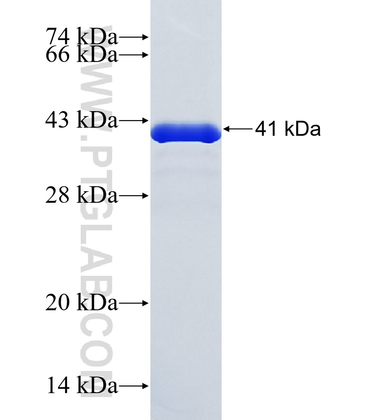 MEIKIN fusion protein Ag36937 SDS-PAGE MEIKIN fusion protein Ag36937 SDS-PAGE