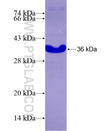 MEIS2 fusion protein Ag28983 SDS-PAGE MEIS2 fusion protein Ag28983 SDS-PAGE