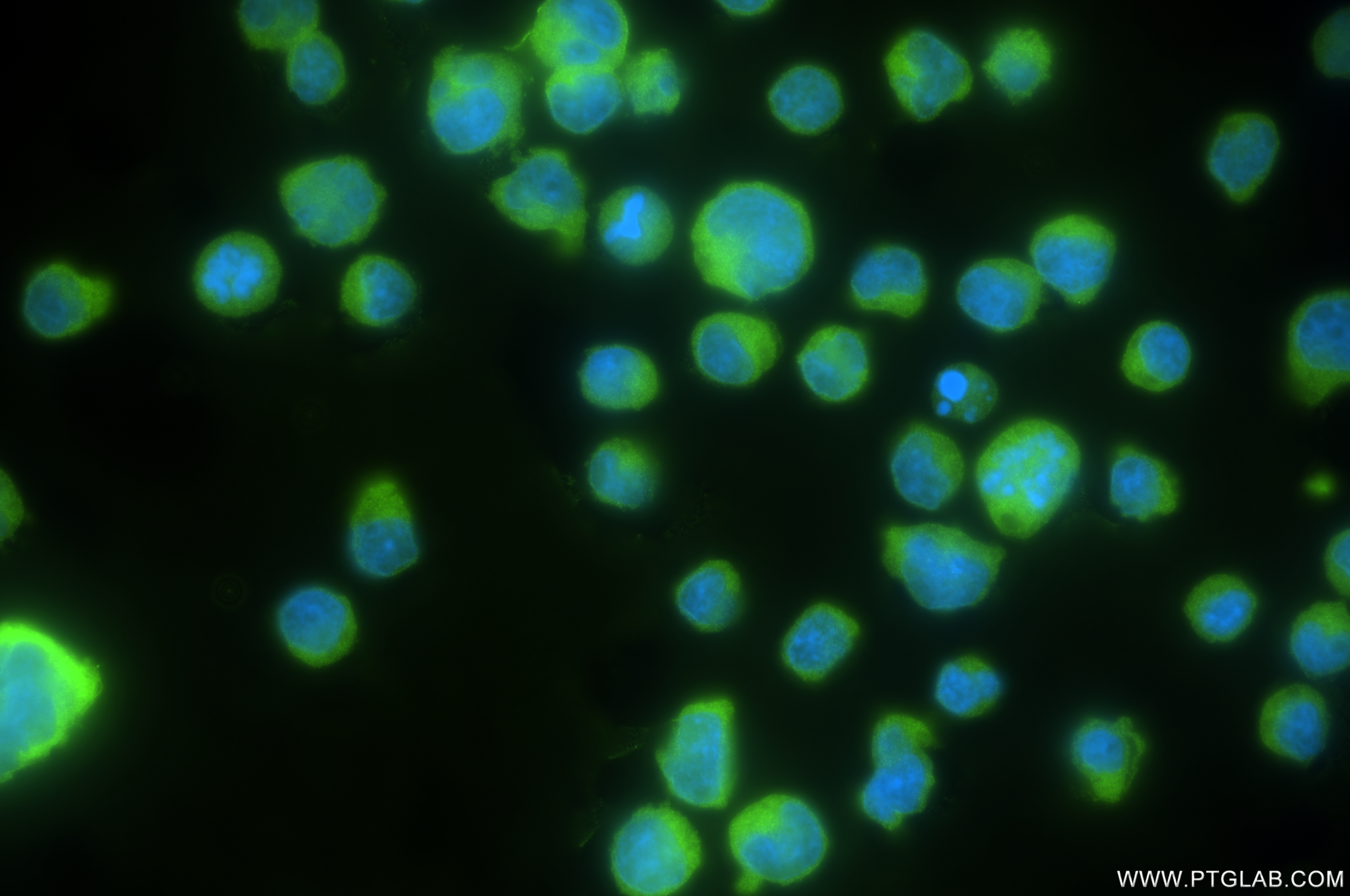 IF Staining of Jurkat using 84967-1-RR