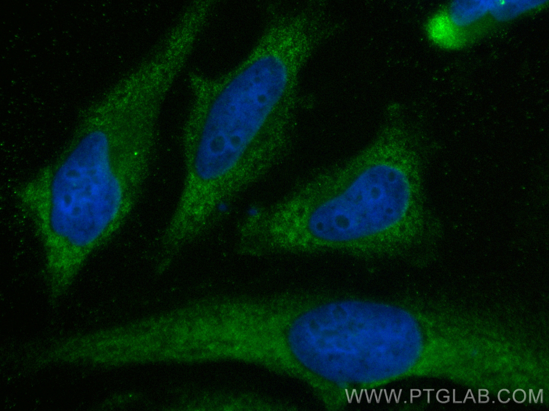 IF Staining of HeLa using CL488-11049