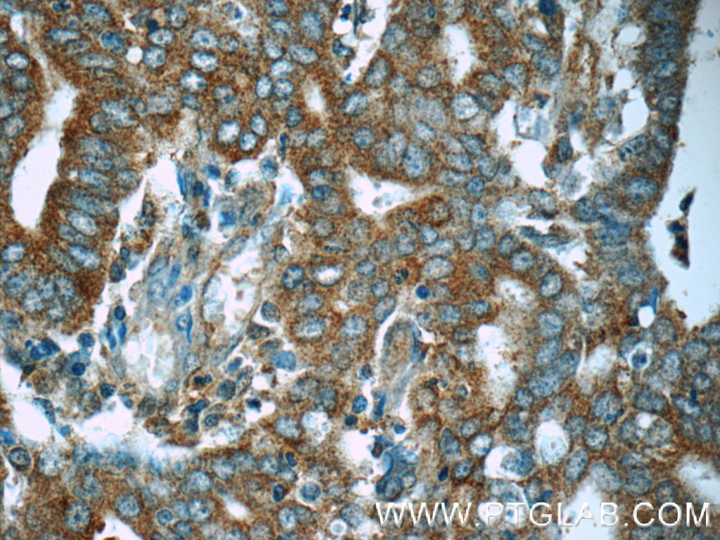 MEK1-Specific Polyclonal antibody