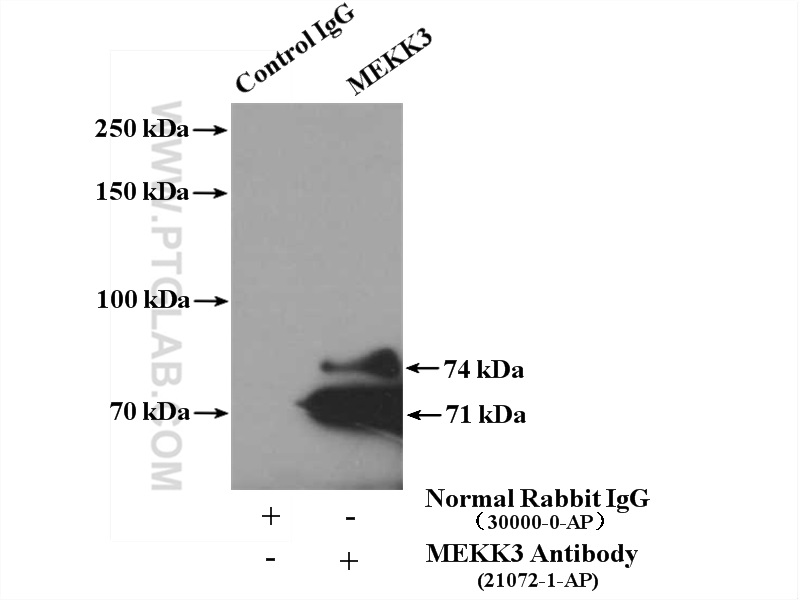 IP experiment of mouse liver using 21072-1-AP