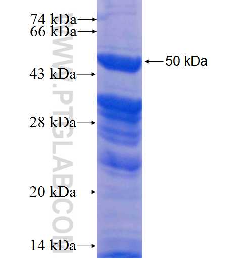 MELK fusion protein Ag4381 SDS-PAGE MELK fusion protein Ag4381 SDS-PAGE