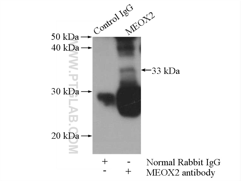 IP experiment of human placenta using 12449-1-AP