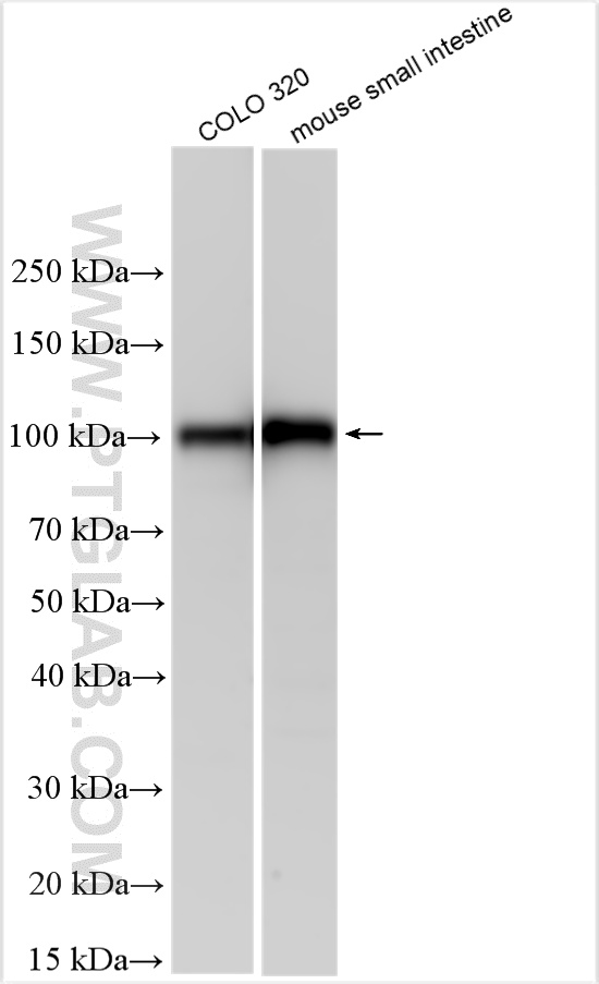 WB analysis using 32828-1-AP