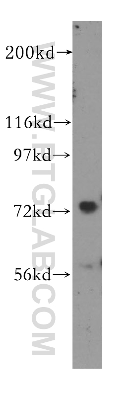 MEPCE Polyclonal antibody