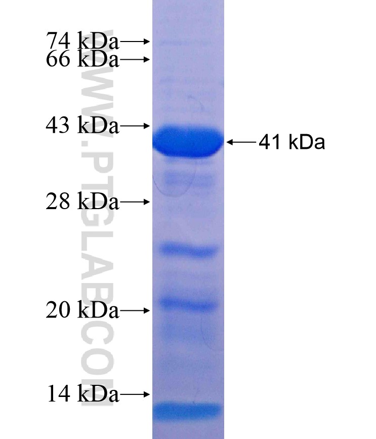 MEPCE fusion protein Ag17956 SDS-PAGE MEPCE fusion protein Ag17956 SDS-PAGE