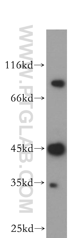 WB analysis of HepG2 using 18804-1-AP