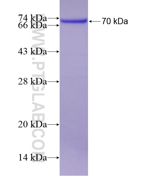 MEPE fusion protein Ag19758 SDS-PAGE