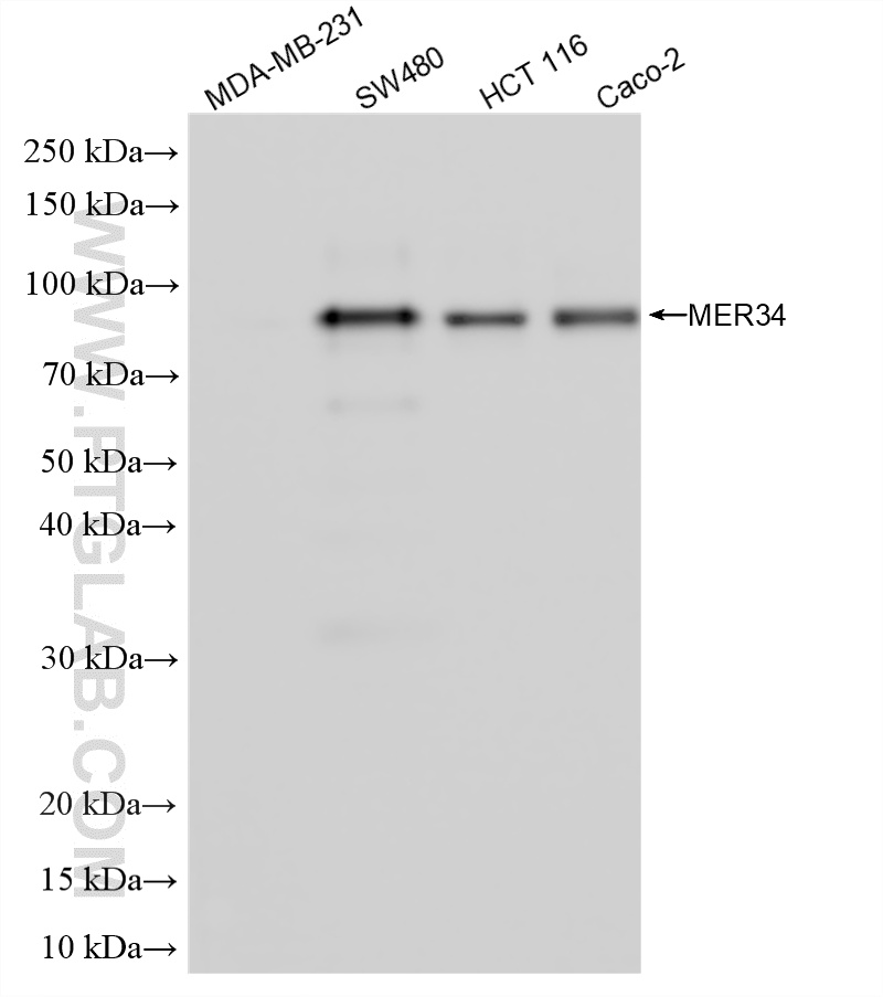 WB analysis using 86925-1-RR