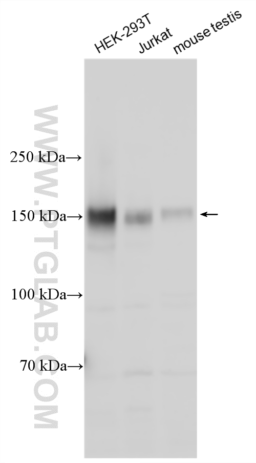 Various lysates were subjected to SDS PAGE followed by western blot with 27900-1-AP (MERTK antibody) at dilution of 1:1000 incubated at room temperature for 1.5 hours. WB analysis using 27900-1-AP