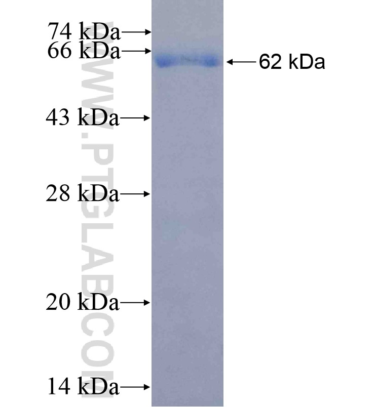 MERTK fusion protein Ag16585 SDS-PAGE MERTK fusion protein Ag16585 SDS-PAGE