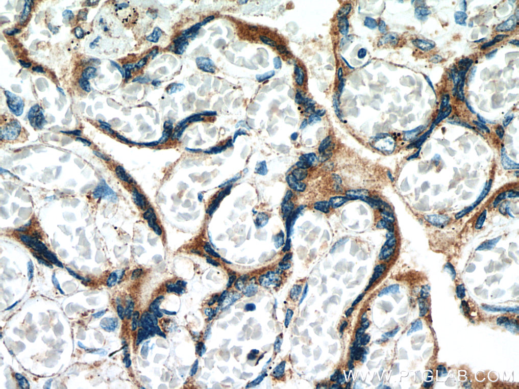 IHC staining of human placenta using 67441-1-Ig