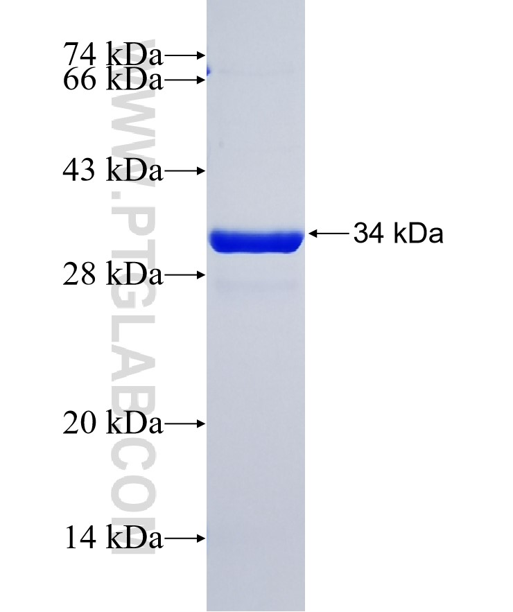 MESP1 fusion protein Ag38017 SDS-PAGE