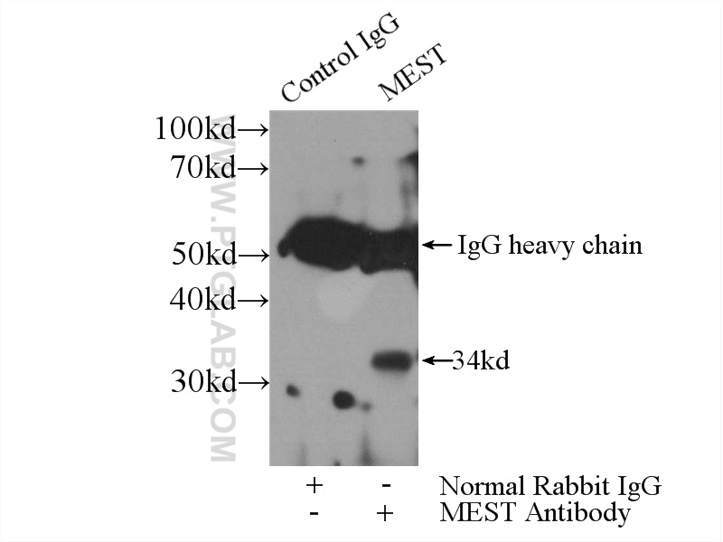 IP experiment of PC-3 using 11118-1-AP