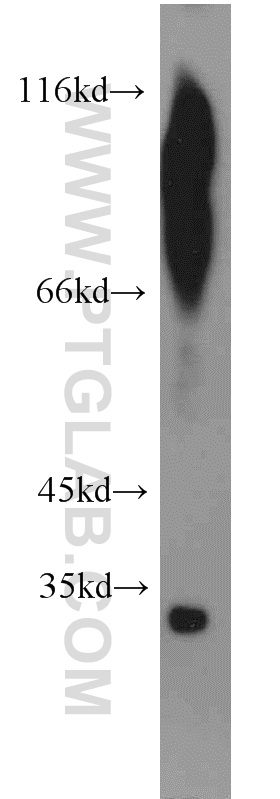 WB analysis of human testis using 11118-1-AP