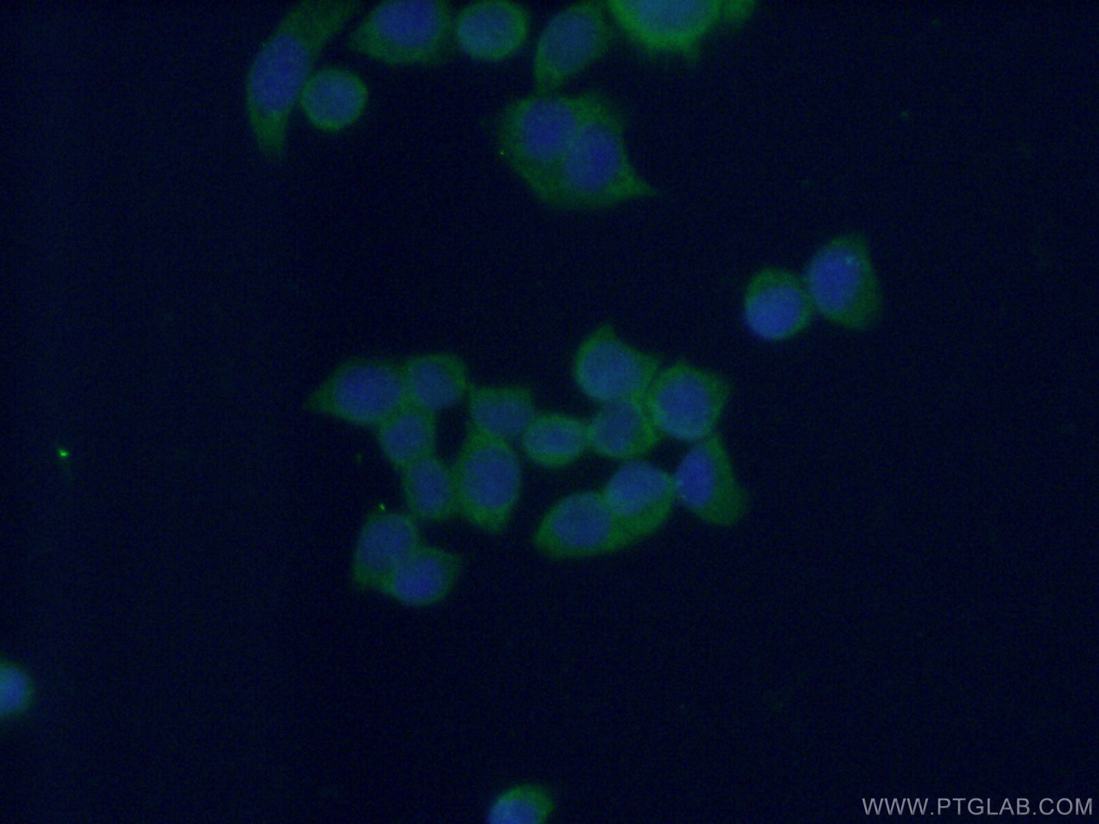 IF Staining of BxPC-3 using 60263-1-Ig