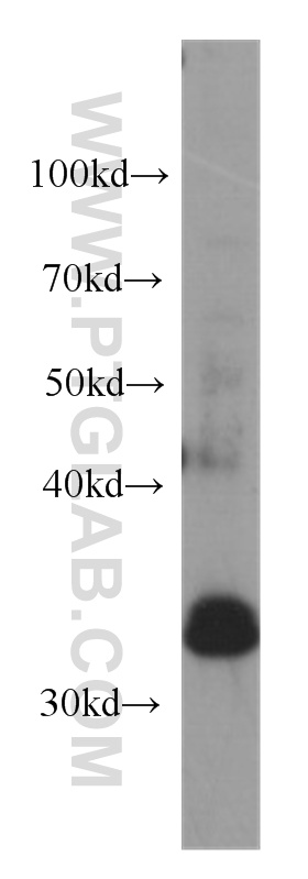 WB analysis of PC-3 using 60263-1-Ig