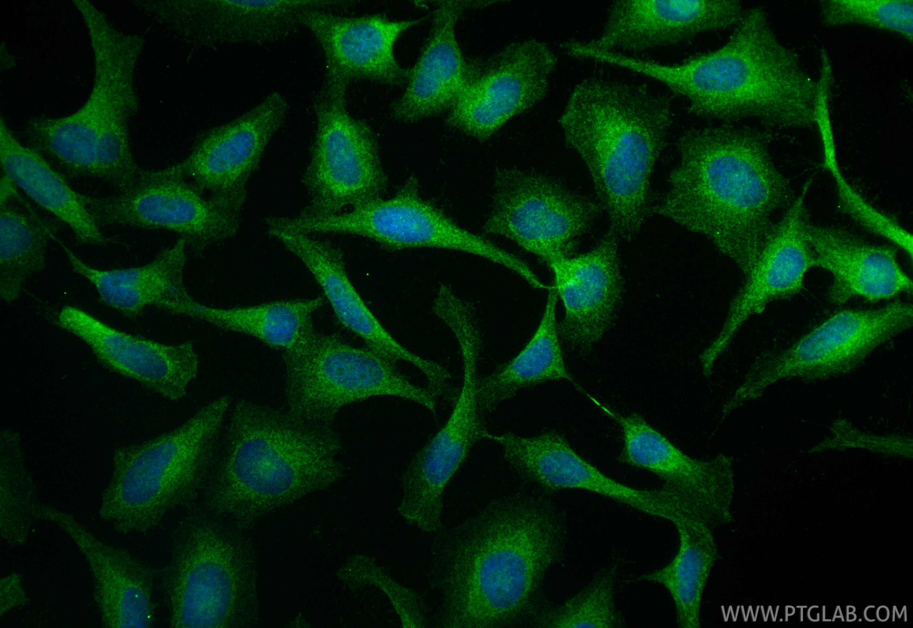 Immunofluorescent analysis of (4% PFA) fixed HeLa cells using c-Met (Cytoplasmic) antibody (25869-1-AP) at dilution of 1:200 and CoraLite®488-Conjugated Goat Anti-Rabbit IgG(H+L) (<a class='green' href='/productredirect?CatalogNo=SA00013-2' target='_blank'>SA00013-2</a>). IF Staining of HeLa using 25869-1-AP