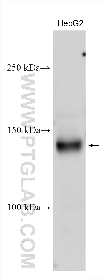 HepG2 cells lysates were subjected to SDS PAGE followed by western blot with 25869-1-AP (c-Met (Cytoplasmic) antibody) at dilution of 1:6000 incubated at room temperature for 1.5 hours. WB analysis using 25869-1-AP