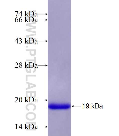 MET fusion protein Ag28405 SDS-PAGE