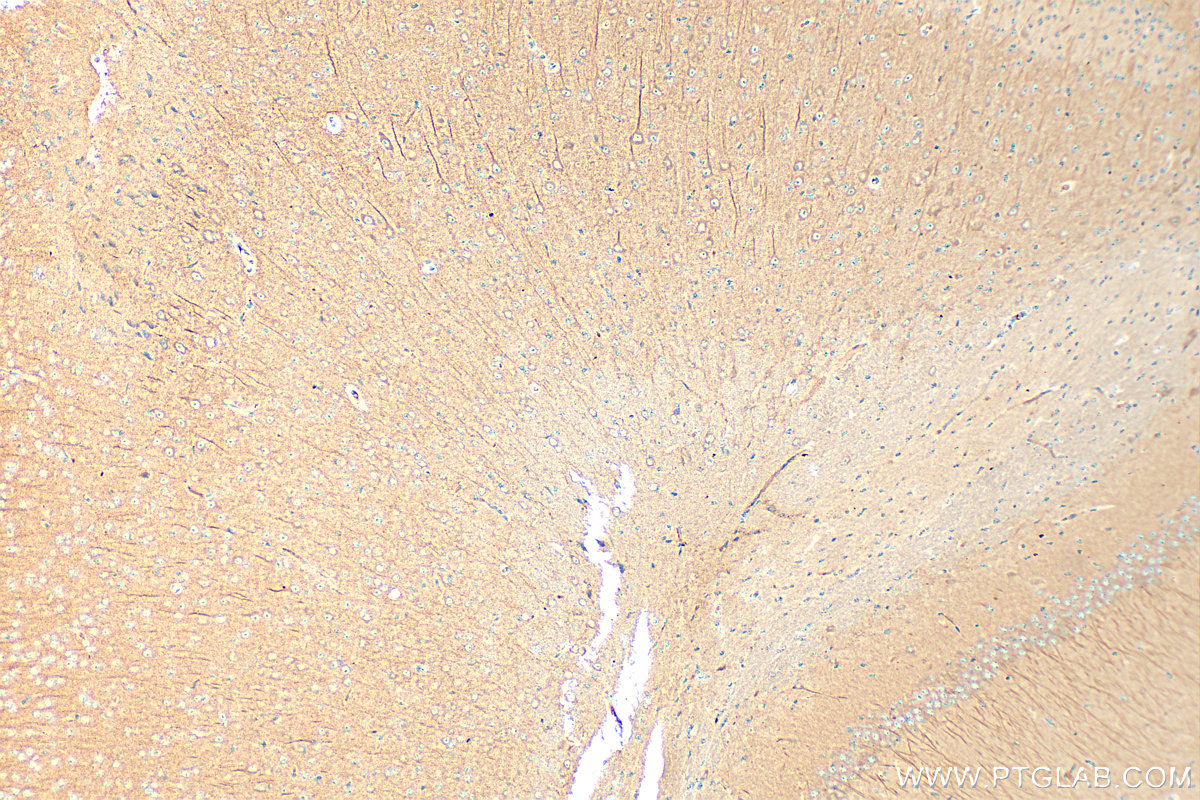 IHC staining of mouse brain using 16327-1-AP