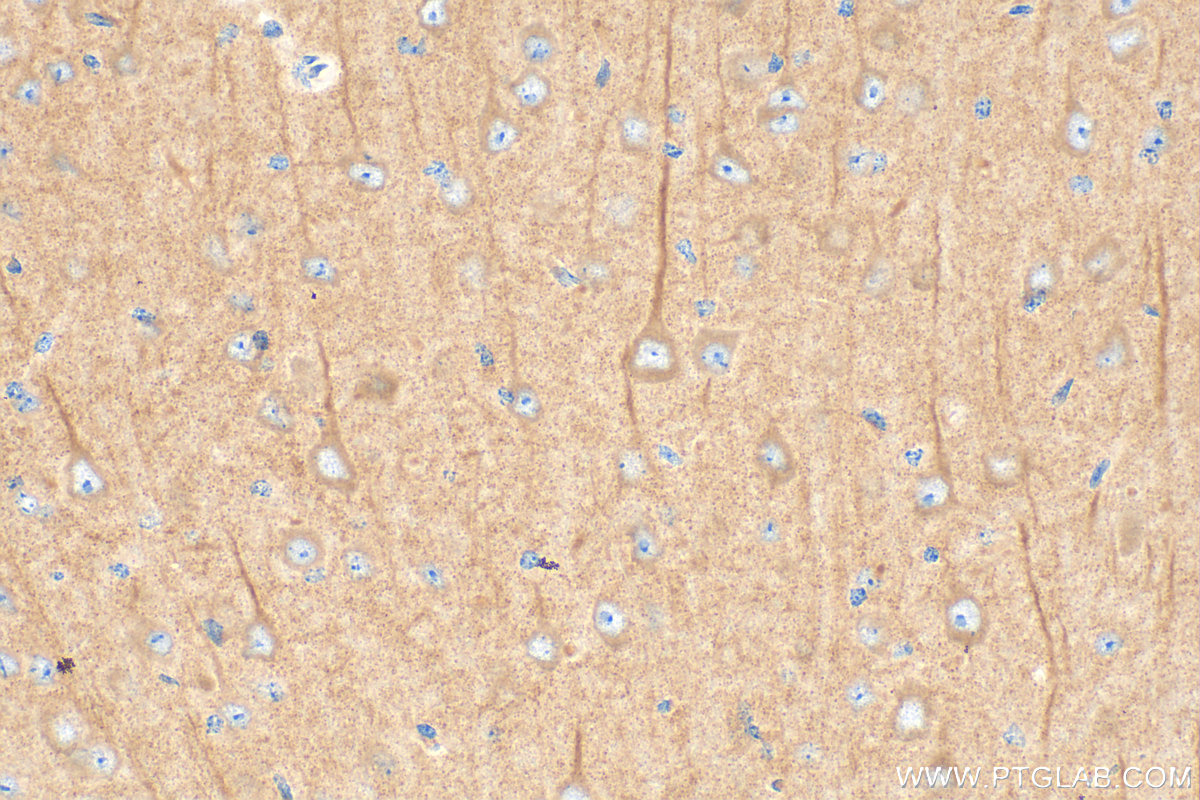 IHC staining of mouse brain using 16327-1-AP