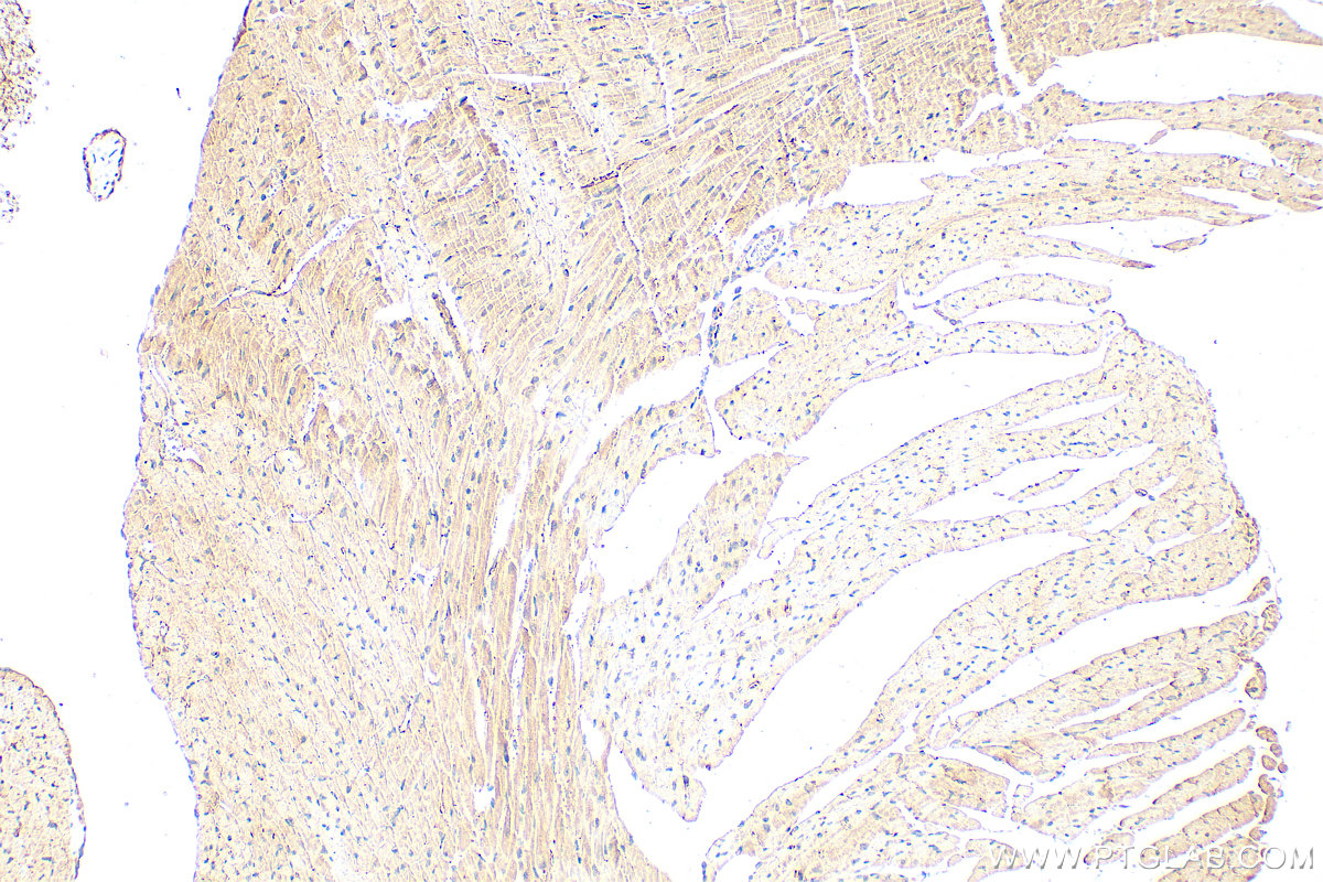 IHC staining of mouse heart using 16327-1-AP