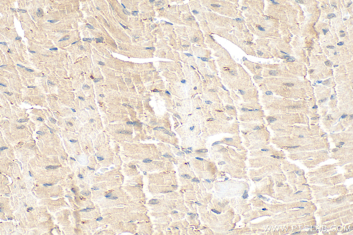 IHC staining of mouse heart using 16327-1-AP