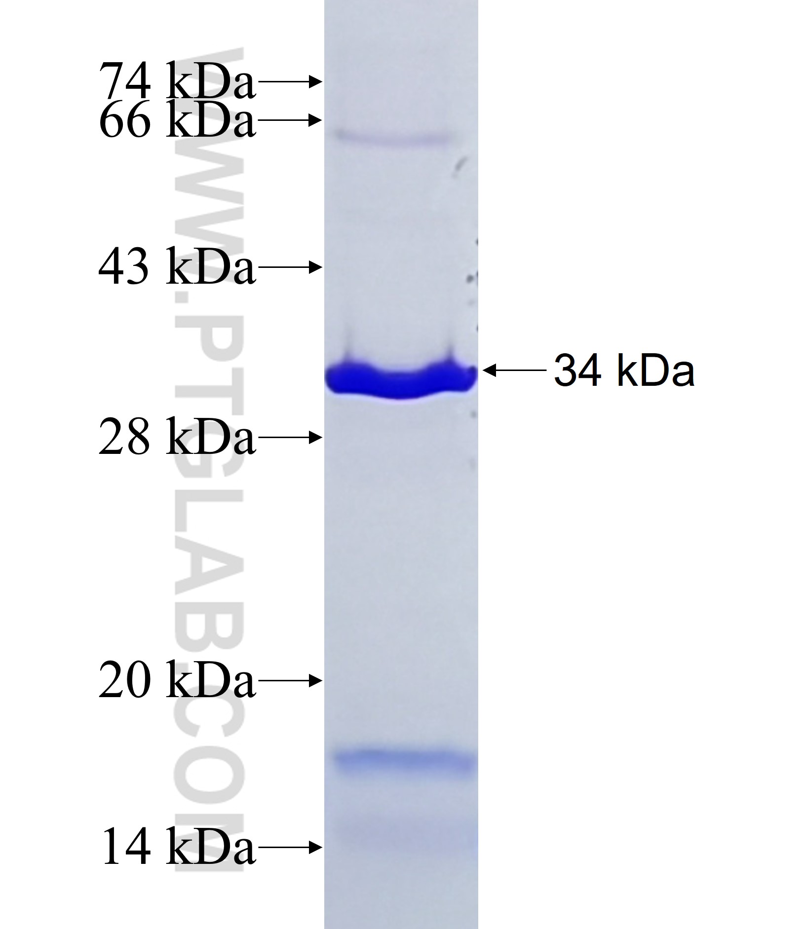 METRNL fusion protein Ag37466 SDS-PAGE