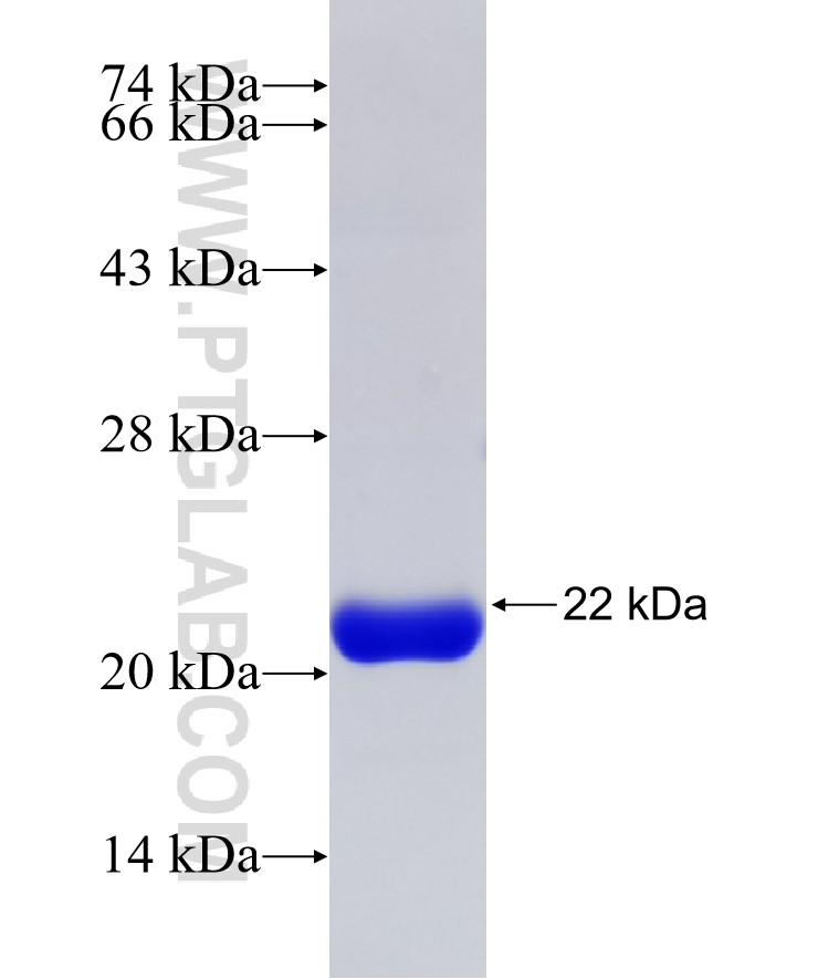 METT5D1 fusion protein Ag31876 SDS-PAGE METT5D1 fusion protein Ag31876 SDS-PAGE