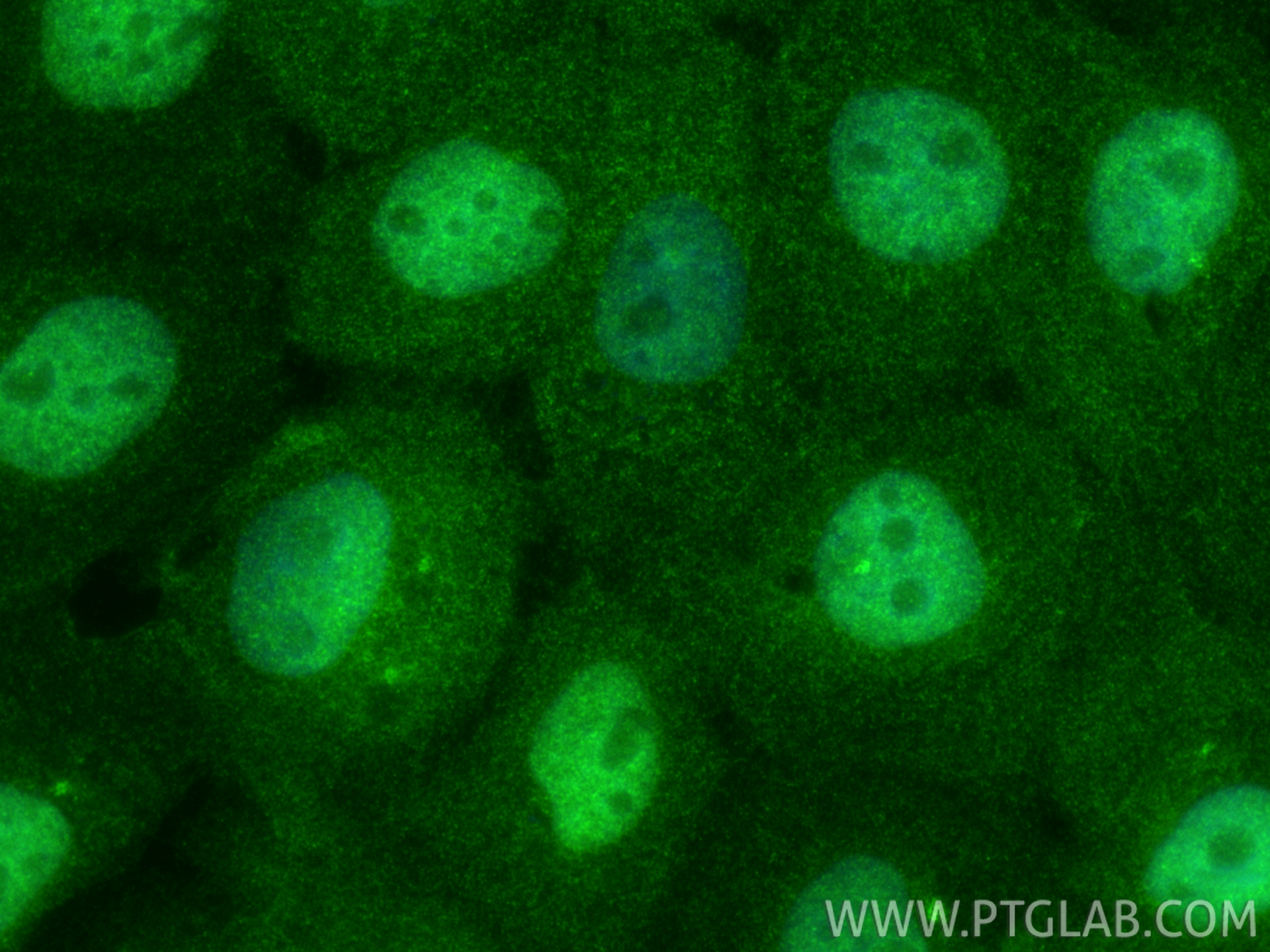 IF Staining of A431 using 33763-1-AP (same clone as 33763-1-PBS)