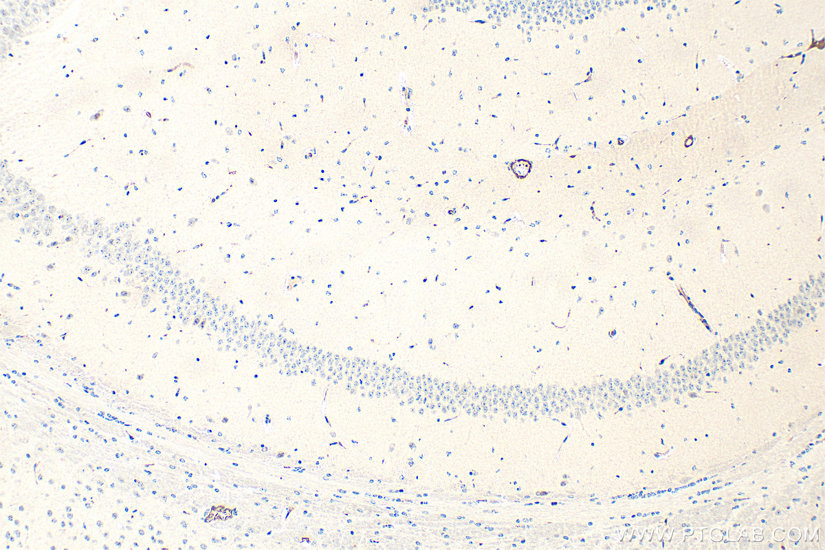 IHC staining of mouse brain using 33763-1-AP (same clone as 33763-1-PBS)