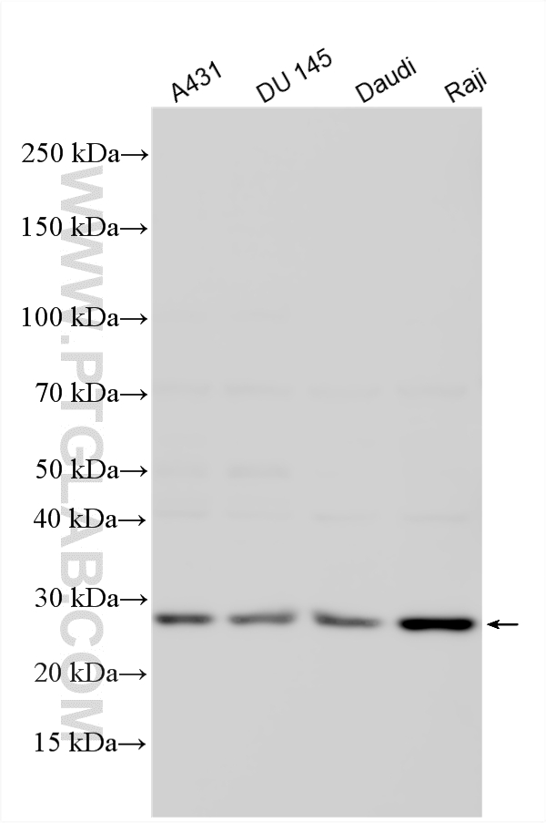 WB analysis using 33763-1-AP (same clone as 33763-1-PBS)