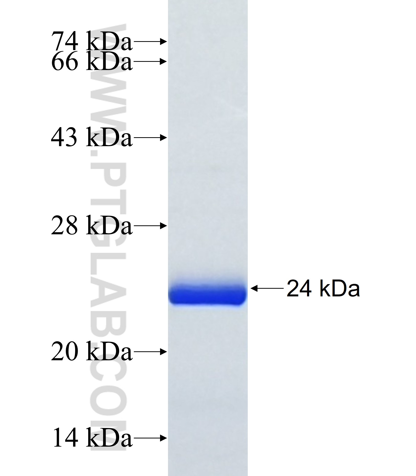 METTL10 fusion protein Ag37025 SDS-PAGE METTL10 fusion protein Ag37025 SDS-PAGE