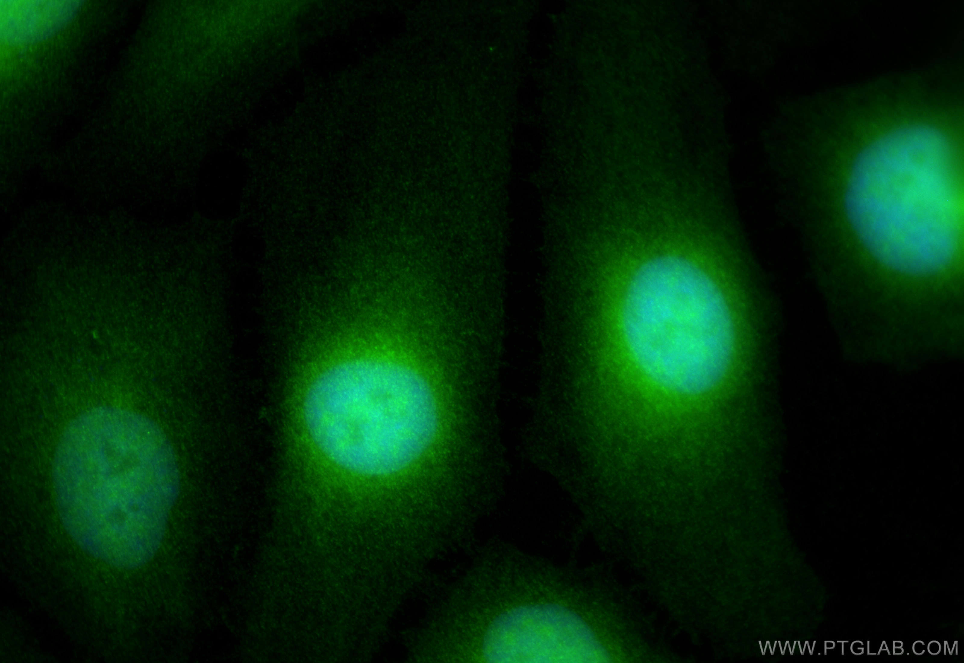 IF Staining of HeLa using 17184-1-AP