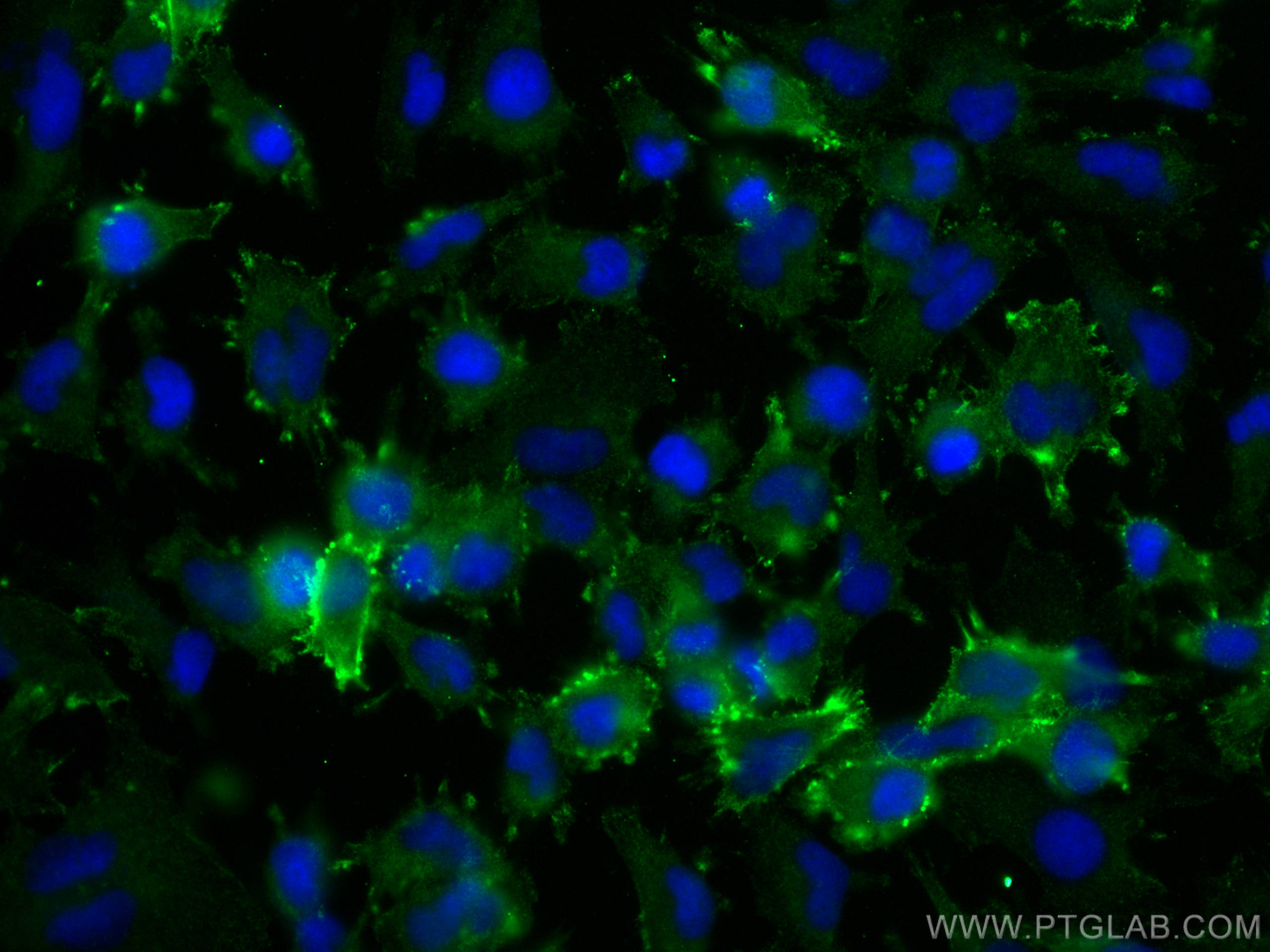 IF Staining of U-251 using 24379-1-AP IF Staining of U-251 using 24379-1-AP