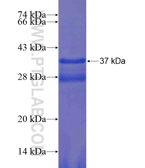 METTL13 fusion protein Ag19355 SDS-PAGE METTL13 fusion protein Ag19355 SDS-PAGE