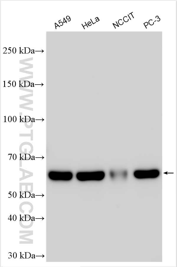 WB analysis using 26158-1-AP