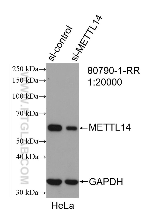 METTL14