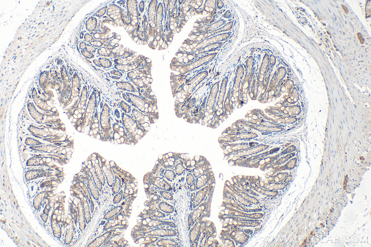 IHC staining of mouse colon using 20890-1-AP IHC staining of mouse colon using 20890-1-AP