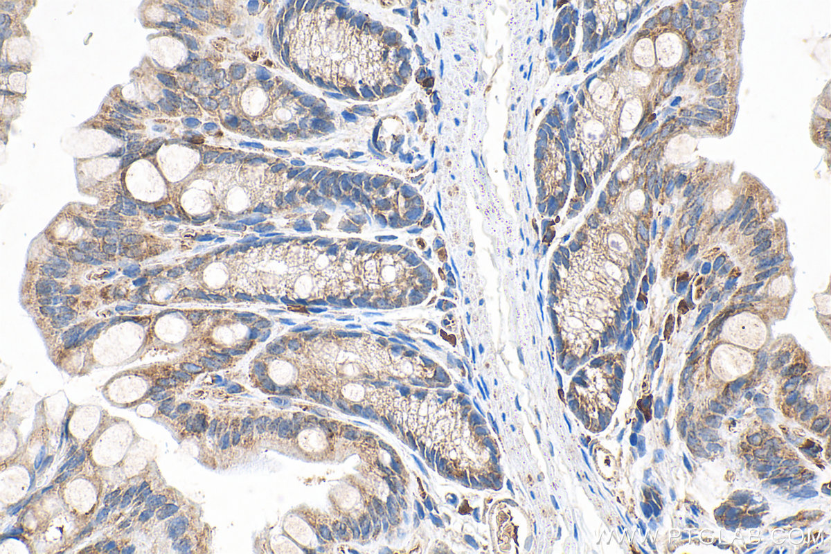 IHC staining of mouse colon using 20890-1-AP IHC staining of mouse colon using 20890-1-AP