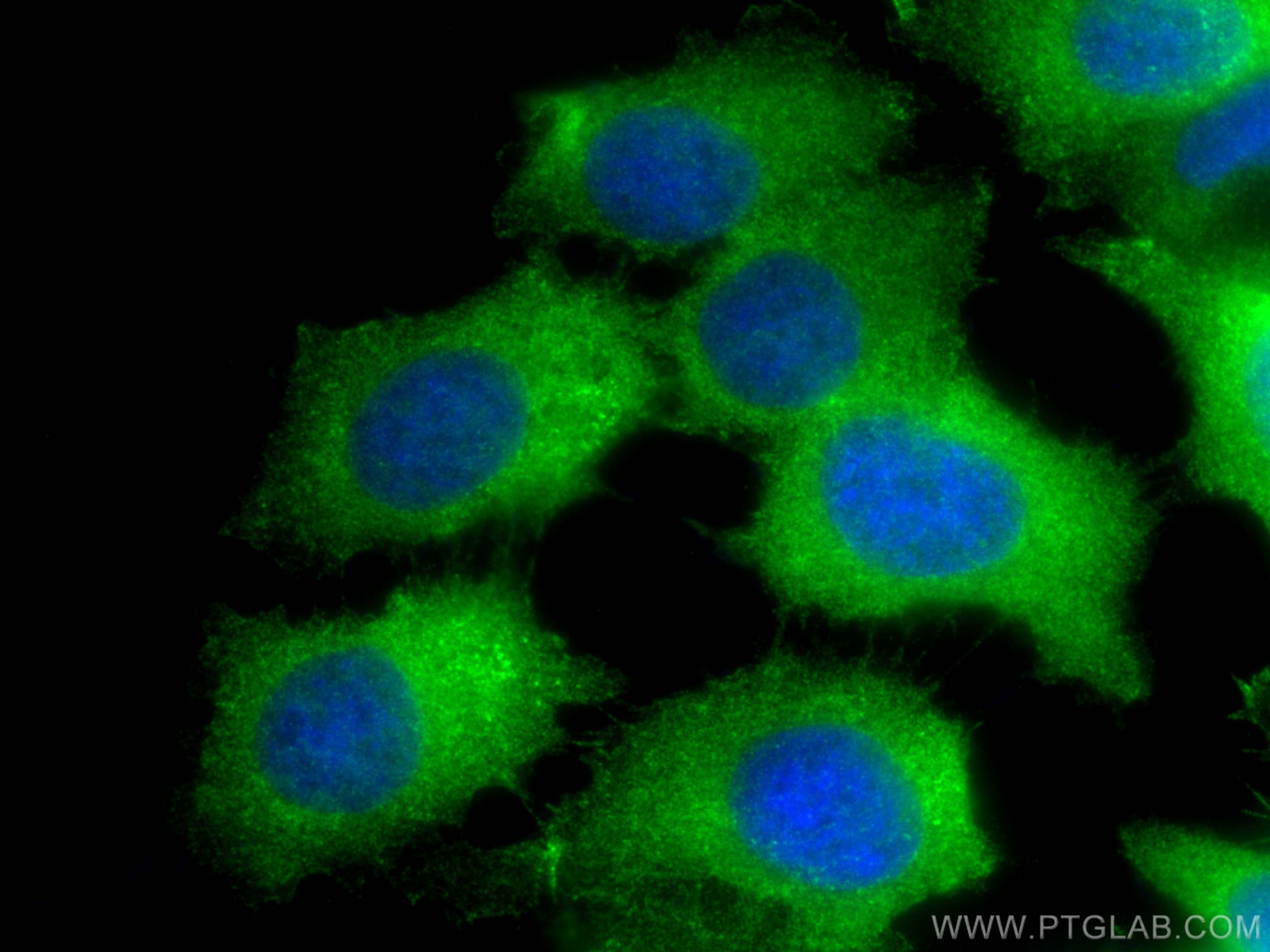 IF Staining of MCF-7 using 16983-1-AP