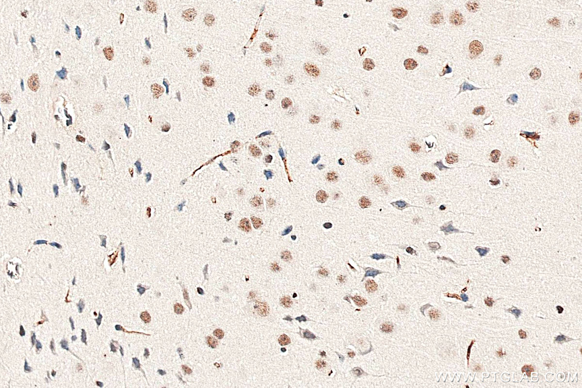 IHC staining of mouse brain using 67733-1-Ig