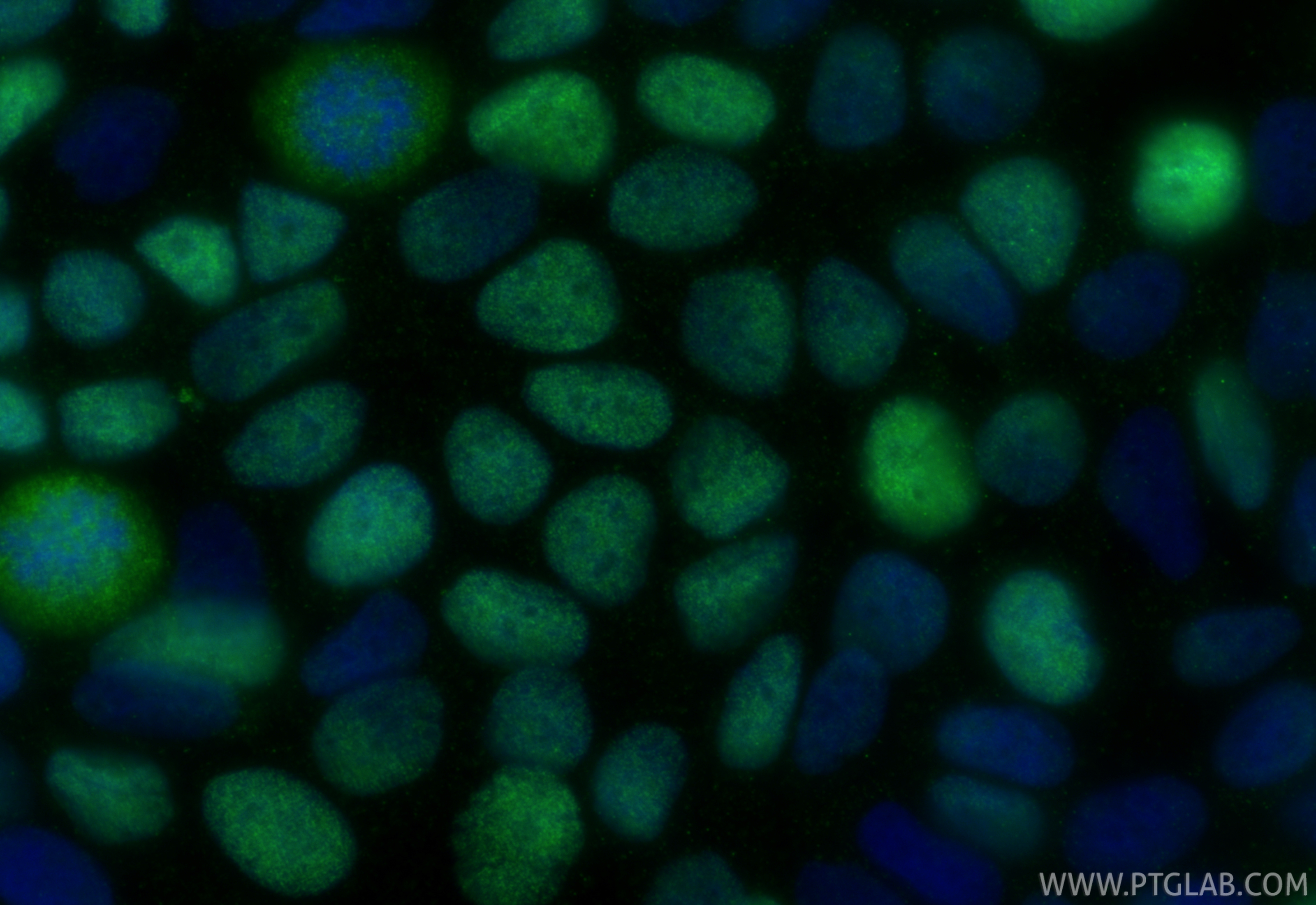 Immunofluorescent analysis of (4% PFA) fixed MCF-7 cells using METTL3 antibody (80323-1-RR, Clone: 2I9 ) at dilution of 1:200 and CoraLite®488-Conjugated Goat Anti-Rabbit IgG(H+L) (<a class='green' href='/productredirect?CatalogNo=SA00013-2' target='_blank'>SA00013-2</a>). IF Staining of MCF-7 using 80323-1-RR