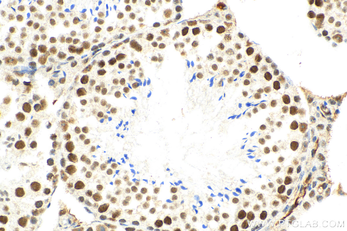 IHC staining of mouse testis using 80323-1-RR